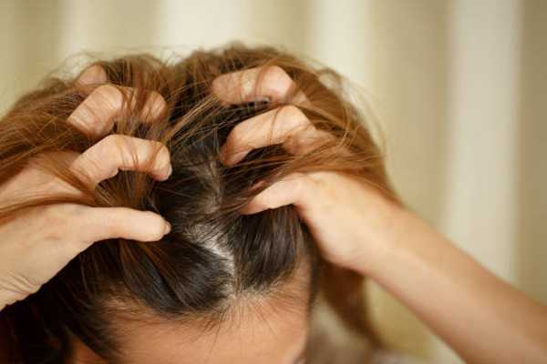 Effective Treatment Options for Severe Scalp Psoriasis