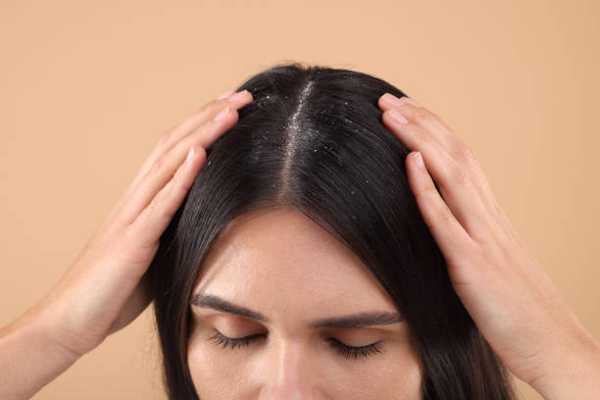 A Guide to Understanding and Treating Scalp Psoriasis in Older Adults