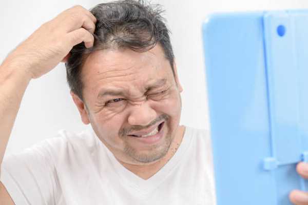 Scalp Psoriasis: Signs, Symptoms and Effective Treatments