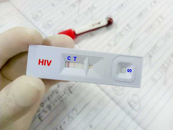 HIV Prevention and Treatment