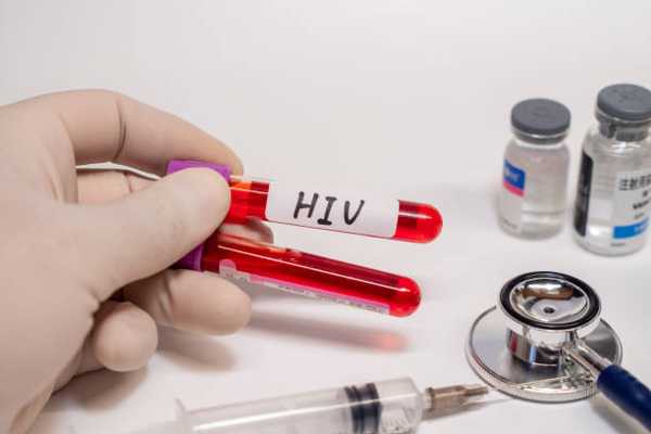 Understanding the Early Symptoms of HIV: How to Detect the Virus Early