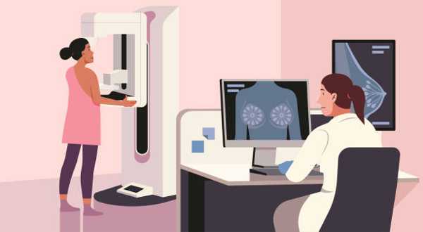 Recognizing Early Signs of Breast Cancer: Your Guide to Early Detection