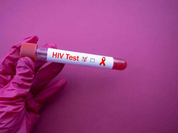 Exploring HIV Treatment Options: Medications, Management, and Support Systems