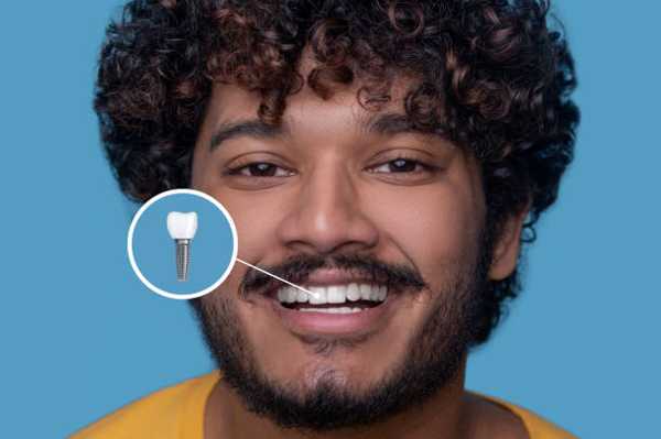 Reliable Dental Implants: A Long-Term Solution for Oral Health